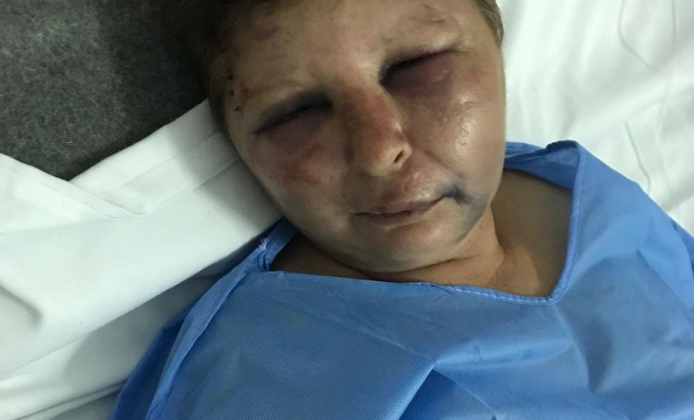 Femeie bătută de un polițist din Potcoava!   Agentul, cercetat penal și disciplinar