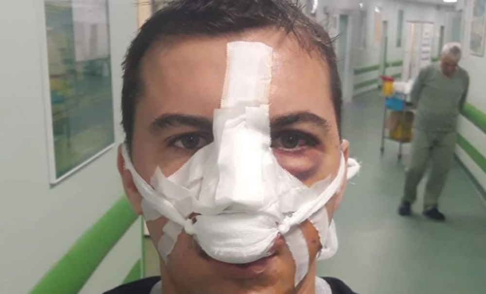 Unul dintre poliţiştii bătuţi de un cland de rromi din Vâlcea a fost operat